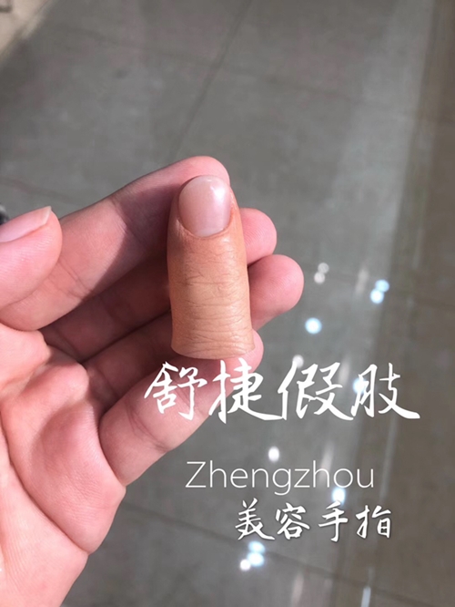 安裝假手指的醫院和費用？